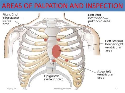 palpable right ventricular lift.